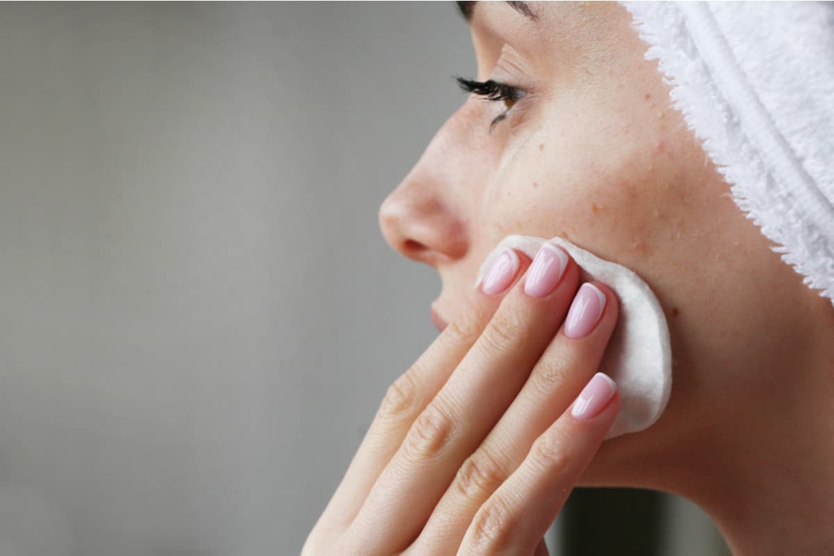 come curare acne viso